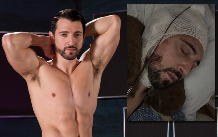 brain surgery complications gay porn star jimmy durano