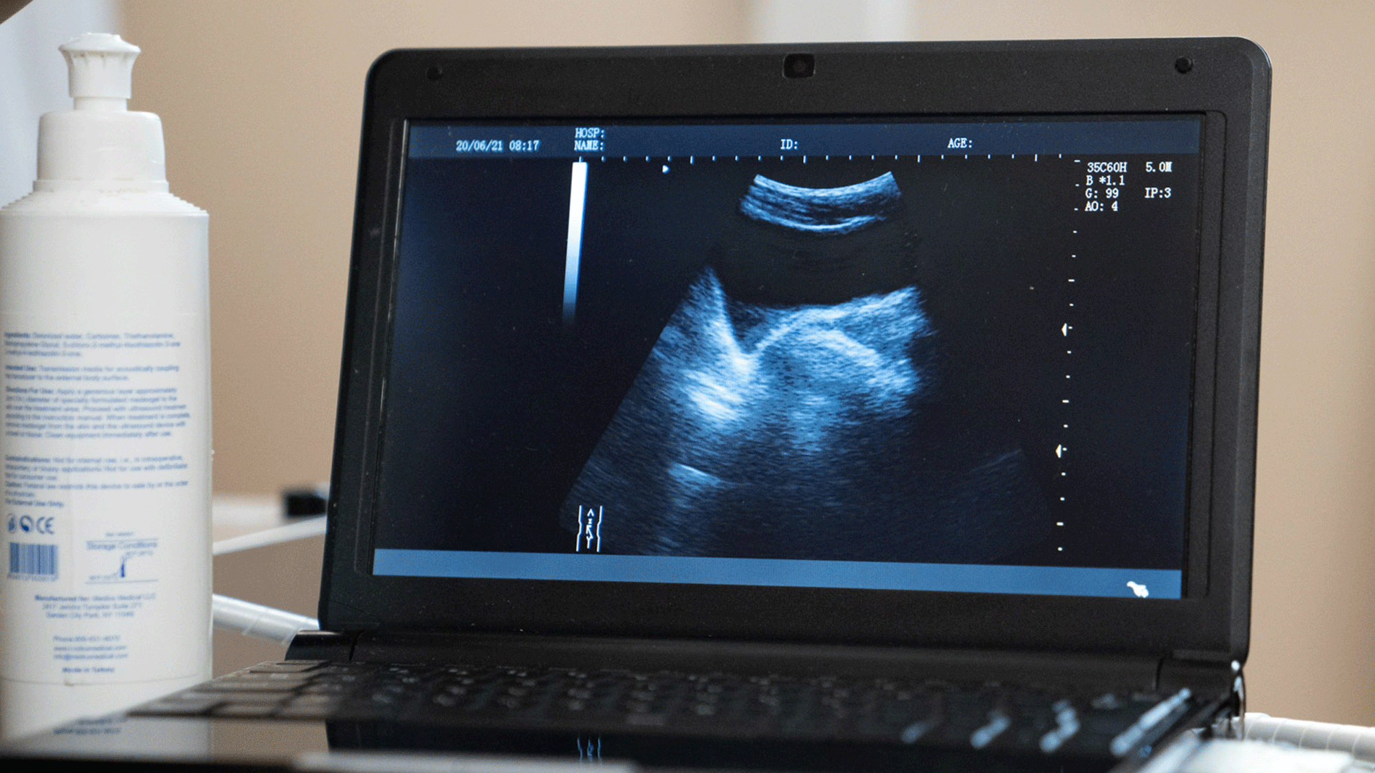Ultrasound Anal Sex - Here's What An Ultrasound Of Someone Getting Butt Fucked Looks Like -  TheSword.com